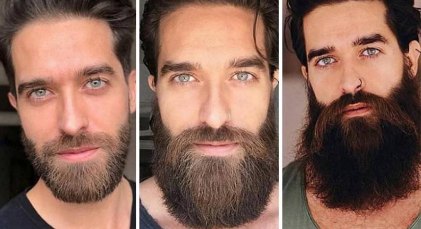 Почему щетина плохо растет и как сделать бороду гуще?
