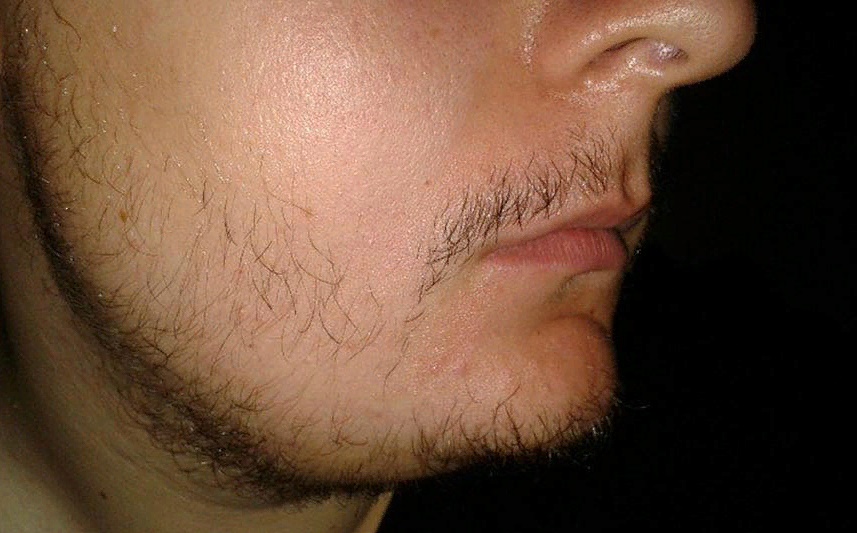 Как отрастить бороду если она не растет: гайд и пошаговая инструкция