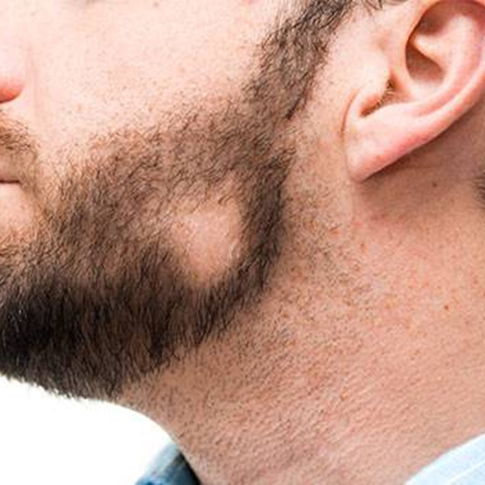 Как убрать бороду на подбородке