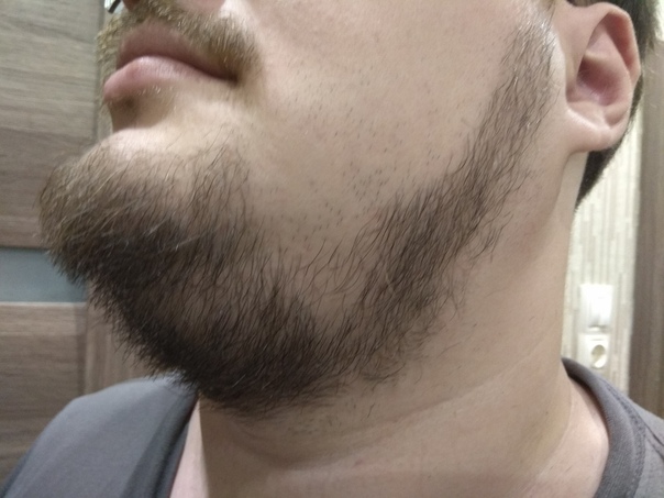 Как отрастить бороду, если волосы редкие: способы повышения густоты