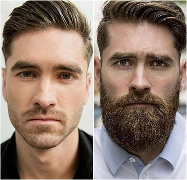 Можно ли ускорить процесс роста бороды?