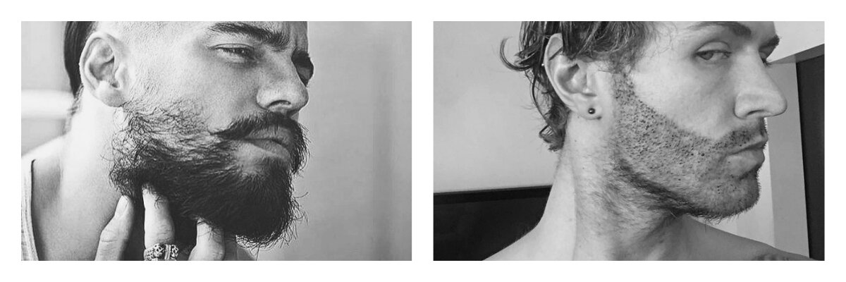Как сделать, чтобы росла борода на щеках: стимуляция роста волос