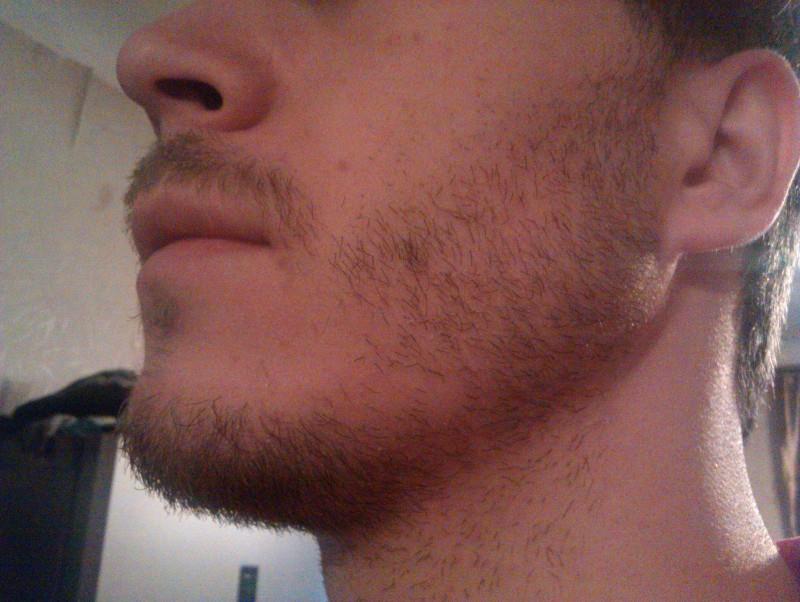 Как растет щетина на щеках и что делать, если она не растет (или делает это неравномерно). сколько по времени и как растет борода у мужчин?