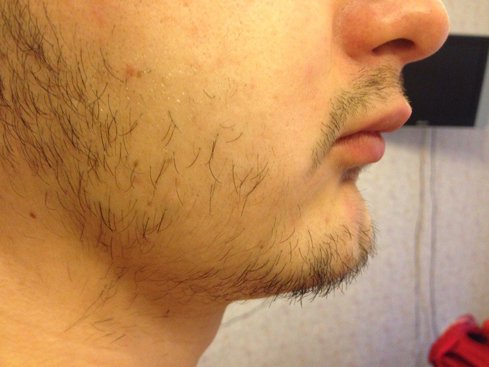 Как отрастить бороду | brodude.ru